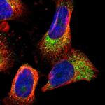 PHLP Polyclonal Antibody