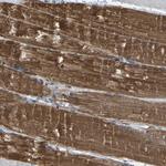 PHLP Antibody in Immunohistochemistry (Paraffin) (IHC (P))