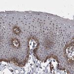 ZNF750 Antibody in Immunohistochemistry (IHC)