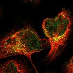 TRIM65 Polyclonal Antibody