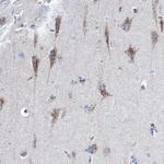 TRIM65 Antibody in Immunohistochemistry (Paraffin) (IHC (P))