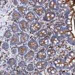 TRIM65 Antibody in Immunohistochemistry (Paraffin) (IHC (P))