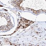 TRIM65 Antibody in Immunohistochemistry (Paraffin) (IHC (P))