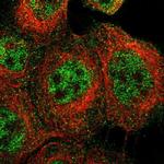 TRIM65 Polyclonal Antibody