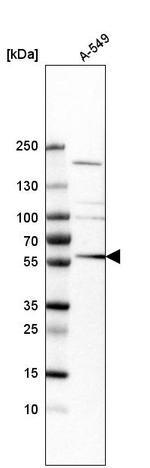 TRIM65 Antibody in Western Blot (WB)