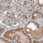 SCO1 Antibody in Immunohistochemistry (IHC)