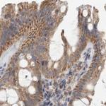 SCO1 Antibody in Immunohistochemistry (IHC)