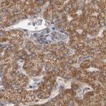 SCO1 Antibody in Immunohistochemistry (IHC)