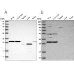 SCO1 Antibody in Western Blot (WB)