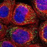 PECR Polyclonal Antibody