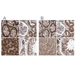 PECR Antibody in Immunohistochemistry (IHC)