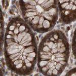 PECR Antibody in Immunohistochemistry (IHC)