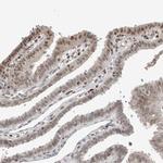 ZNF592 Antibody in Immunohistochemistry (IHC)