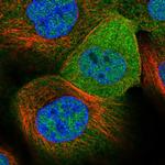 C17orf25 Polyclonal Antibody