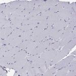Actin-like 7A Antibody in Immunohistochemistry (Paraffin) (IHC (P))