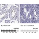 Actin-like 7A Antibody in Immunohistochemistry (IHC)
