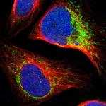 CCDC44 Polyclonal Antibody