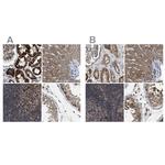 CCDC44 Antibody in Immunohistochemistry (IHC)