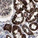 CCDC44 Antibody in Immunohistochemistry (IHC)
