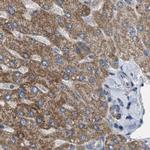 CCDC44 Antibody in Immunohistochemistry (IHC)