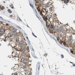 CCDC44 Antibody in Immunohistochemistry (IHC)