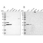 CCDC44 Antibody in Western Blot (WB)