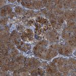 CYB5D1 Antibody in Immunohistochemistry (Paraffin) (IHC (P))