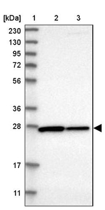CYB5D1 Antibody in Western Blot (WB)