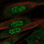 EFCAB13 Polyclonal Antibody