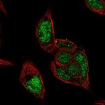 RCOR2 Polyclonal Antibody