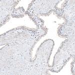 RCOR2 Antibody in Immunohistochemistry (Paraffin) (IHC (P))