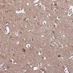 RCOR2 Antibody in Immunohistochemistry (IHC)