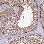 RCOR2 Antibody in Immunohistochemistry (IHC)