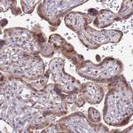 RCOR2 Antibody in Immunohistochemistry (IHC)