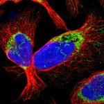 CCDC44 Polyclonal Antibody