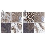 CCDC44 Antibody in Immunohistochemistry (IHC)
