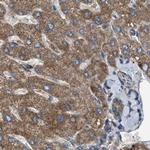 CCDC44 Antibody in Immunohistochemistry (IHC)
