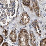 CCDC44 Antibody in Immunohistochemistry (IHC)