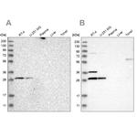 CCDC44 Antibody in Western Blot (WB)