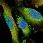 PHLP Polyclonal Antibody