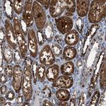 PHLP Antibody in Immunohistochemistry (Paraffin) (IHC (P))