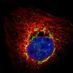 PMPCA Polyclonal Antibody