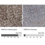 PMPCA Antibody in Immunohistochemistry (IHC)
