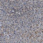 PMPCA Antibody in Immunohistochemistry (IHC)