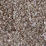 PMPCA Antibody in Immunohistochemistry (IHC)