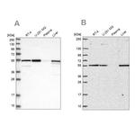 PMPCA Antibody in Western Blot (WB)
