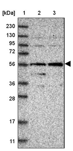 DENND6B Antibody in Western Blot (WB)