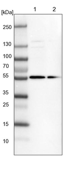 DENND6B Antibody in Western Blot (WB)