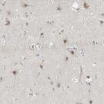 CERCAM Polyclonal Antibody