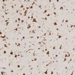 INTS1 Antibody in Immunohistochemistry (Paraffin) (IHC (P))